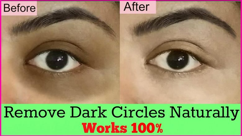download removing dark circles under eyes
